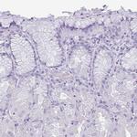 KRT78 Antibody in Immunohistochemistry (Paraffin) (IHC (P))