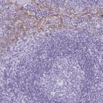KRT78 Polyclonal Antibody