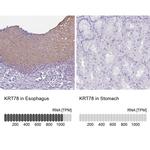 KRT78 Antibody in Immunohistochemistry (IHC)