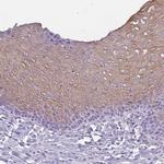 KRT78 Antibody in Immunohistochemistry (IHC)