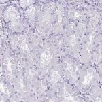 KRT78 Antibody in Immunohistochemistry (IHC)