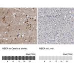 NBEA Antibody in Immunohistochemistry (IHC)