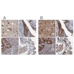 NBEA Antibody in Immunohistochemistry (IHC)