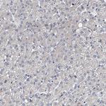 NBEA Antibody in Immunohistochemistry (IHC)
