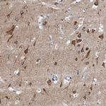 NBEA Antibody in Immunohistochemistry (IHC)