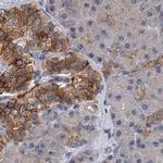 NBEA Antibody in Immunohistochemistry (IHC)
