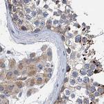 NBEA Antibody in Immunohistochemistry (IHC)