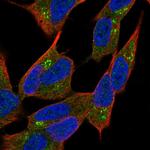 NBEA Polyclonal Antibody