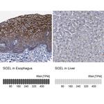 SCEL Antibody in Immunohistochemistry (IHC)