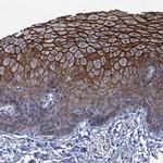 SCEL Antibody in Immunohistochemistry (IHC)