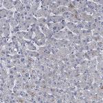 SCEL Antibody in Immunohistochemistry (IHC)