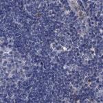 SCEL Antibody in Immunohistochemistry (IHC)