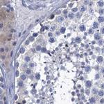 SCEL Antibody in Immunohistochemistry (IHC)