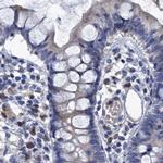 SCEL Antibody in Immunohistochemistry (IHC)