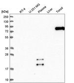 SCEL Antibody in Western Blot (WB)