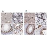CSTF3 Antibody in Immunohistochemistry (IHC)