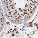CSTF3 Antibody in Immunohistochemistry (IHC)