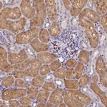 OSGEP Antibody in Immunohistochemistry (Paraffin) (IHC (P))