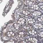 TPCN1 Antibody in Immunohistochemistry (Paraffin) (IHC (P))