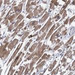 TPCN1 Antibody in Immunohistochemistry (Paraffin) (IHC (P))