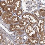 TPCN1 Antibody in Immunohistochemistry (Paraffin) (IHC (P))