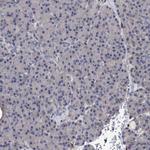 TPCN1 Antibody in Immunohistochemistry (Paraffin) (IHC (P))