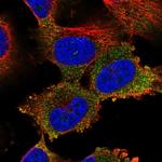 NAA16 Polyclonal Antibody