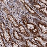 LRRC63 Antibody in Immunohistochemistry (Paraffin) (IHC (P))