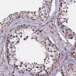 GPN3 Antibody in Immunohistochemistry (IHC)