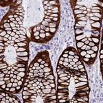 INSC Antibody in Immunohistochemistry (Paraffin) (IHC (P))