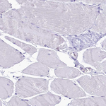INSC Antibody in Immunohistochemistry (Paraffin) (IHC (P))