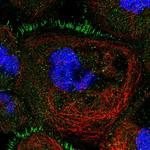 TBC1D30 Polyclonal Antibody