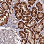 TBC1D30 Antibody in Immunohistochemistry (Paraffin) (IHC (P))
