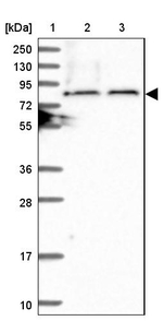 TBC1D30 Antibody in Western Blot (WB)