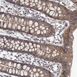 ZNF324 Polyclonal Antibody