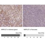 MRPL57 Polyclonal Antibody