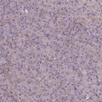 MRPL57 Antibody in Immunohistochemistry (IHC)