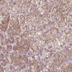 MRPL57 Antibody in Immunohistochemistry (IHC)