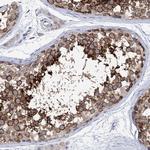 SSSCA1 Antibody in Immunohistochemistry (Paraffin) (IHC (P))
