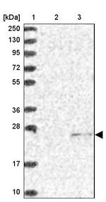 SSSCA1 Antibody in Western Blot (WB)
