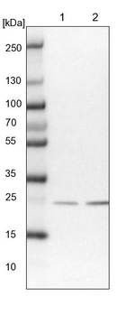 SSSCA1 Antibody in Western Blot (WB)
