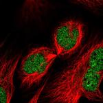 RUFY2 Polyclonal Antibody