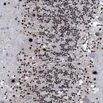 RUFY2 Antibody in Immunohistochemistry (Paraffin) (IHC (P))