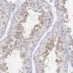 GLIPR1L2 Antibody in Immunohistochemistry (IHC)