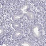 GLIPR1L2 Antibody in Immunohistochemistry (IHC)