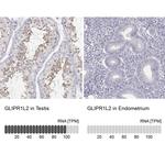 GLIPR1L2 Antibody