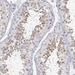 GLIPR1L2 Polyclonal Antibody