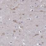 B3GNT6 Polyclonal Antibody