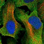 TTC23 Polyclonal Antibody