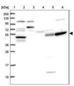 TTC23 Antibody in Western Blot (WB)